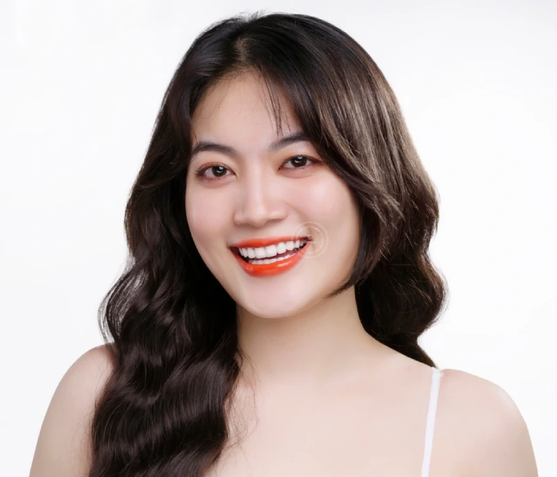 Hơn 30.000 khách hàng tin tưởng lựa chọn bọc răng sứ tại Dentos